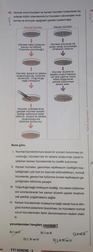 19
18. Normal vücut hücreleri ve kanser hücreleri kullanılarak ha-
zırlanan kültür ortamlarında bu hücrelerin davranışları ince-
lenmiş ve sonuçlar aşağıdaki şekilde özetlenmiştir.
Normal hücreler
Kanser hücreleri
O 0
Hücreler kabin yüzeyine
tutunur ve böl