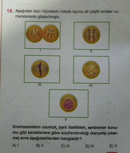 18. Aşağıdaki bazı hücrelerin mitotik fazına ait çeşitli evreler nu-
maralanarak gösterilmiştir.
Juods
IV
V
Kromozomların uzunluk, bant özellikleri, sentromer konu-
mu gibi karakterlere göre sınıflandırıldığı (karyotip çıkar-
ma) evre aşağıdakilerden hangi