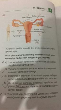 F1 / DENEME - 1 A
HI
40.
Döllenme borusu
Yumurtalıklar
Foliküller
Rahim
Rahim duvarı
Endometriyum
IV
Rahim ağzı
Vajina
Yukarıdaki şekilde insanda dişi üreme sisteminin yapısı
gösterilmiştir.
Buna göre numaralandırılmış kısımlar ile ilgili seçe-
neklerdeki ifadelerden hangisi doğru değildir?
A) I numaralı kısım hem üreme hücresi hem de hormon
üretebilen bir karma bezdir.
B) Yumurta ve spermin çekirdeklerinin kaynaşması 11
numaralı kısımda gerçekleşir.
C) Döllenmenin ardından Ill numaralı yapıya yerleşen
embriyo doğuma kadar gelişimini burada tamamlar.
D) Menstrüasyon döngüsü sırasında hipofizden sal-
gilanan LH hormonu etkisi ile IV numaralı yapının
kalınlığı değişir.
✓E) V numaralı yapı döllenmemiş yumurtanın atılmasını
ve doğumun gerçekleşmesini sağlayan organdır.
