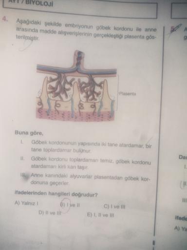 OJİ
4. Aşağıdaki şekilde embriyonun göbek kordonu ile anne
arasında madde alışverişlerinin gerçekleştiği plasenta gös-
terilmiştir.
g
Plasenta
Dal
1
Buna göre,
1. Göbek kordonunun yapısında iki tane atardamar, bir
tane toplardamar bulunur.
Il.
Göbek kordon