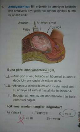 1. Amniyosentez: Bir enjektör ile amniyon kesesin-
den amniyotik sivi çekilir ve sivinin içindeki hücre-
ler analiz edilir.
Ultrason
Amniyon SIVISI
Şiringa
Fetüs
Buna göre, amniyosentezle ilgili,
Amniyon Sivisi, bebeğe ait hücreleri bulundur-
duğu için şırıngayla bir miktar alınır.
I Alinan sivi içindeki hücrelerin incelenmesi sonu-
cu anneye ait kalıtsal hastalıklar belirlenebilir.
III. Bebeğe ait kromozom anormalliklerinin belir-
lenmesini sağlar.
açıklamalarından hangileri doğrudur?
A) Yalnız ! B) Yalnız It c) ve 11
D) I ve III
E) Il ve It
Kafadengi
