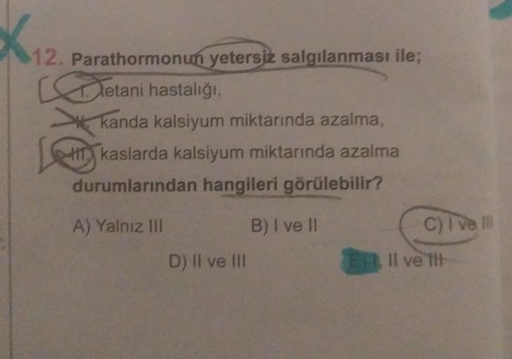 12. Parathormonun yetersiz salgılanması ile;
Tetani hastalığı
kanda kalsiyum miktarında azalma,
Hkaslarda kalsiyum miktarında azalma
durumlarından hangileri görülebilir?
A) Yalnız IN
C) I ve
B) I ve II
D) II ve III
ell
Il ve IH!
