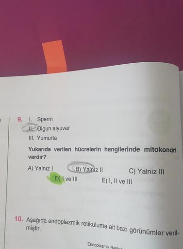 9. I. Sperm
H. Olgun alyuvar
III. Yumurta
Yukarıda verilen hücrelerin hangilerinde mitokondri
vardır?
A) Yalnız 1
B) Yalnız 11
C) Yalnız III
D) I ve III E) I, II ve III
10. Aşağıda endoplazmik retikuluma ait bazı görünümler veril-
miştir.
Endoplazmik Retik