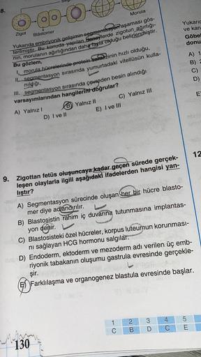 8.
O
Morula
20-0-
Zigot
Blâstomer
Yukaric
ve kan
Göbel
donu
Yukarıda embriyonik gelişimin segmentasyon aşaması gös-
terilmiştir. Bu konuda yapılan deneylerde zigotun
ağırlığı-
nin, morulanın ağırlığından daha fazla olduğu belirlenmiştir.
Bu gözlem,
A) 1
B)