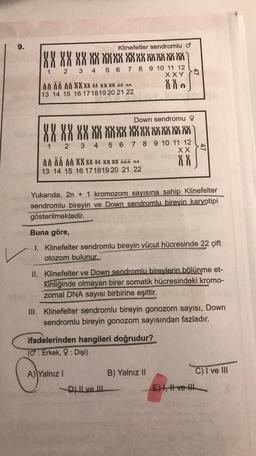 9.
Klinefelter sendromlu o
188 88 88 XX XXXX XXXX XX XX XX XX
1 2 3 4 5 6 7 8 9 10 11 12
XXY
MAN MA X X X X 90 XX XX ää on 88
13 14 15 16 17 1819 20 21 22
Down sendromu
XX XXXX XX XXXX XXXX XXXX XXXX
2 3 4 5 6 7 8 9 10 11 12
XX
MAN MM XXXX an XX xx zää nn
8
13 14 15 16 17 1819 20 21 22
X X
Yukarıda, 2n + 1 kromozom sayısına sahip Klinefelter
sendromlu bireyin ve Down sendromlu bireyin karyotipi
gösterilmektedir.
Buna göre,
1. Klinefelter sendromlu bireyin vücut hücresinde 22 çift
otozom bulunur.
II. Klinefelter ve Down sendromlu bireylerin bölünme et-
kinliğinde olmayan birer somatik hücresindeki kromo-
zomal DNA sayısı birbirine eşittir.
III. Klinefelter sendromlu bireyin gonozom sayısı, Down
sendromlu bireyin gonozom sayısından fazladır.
ifadelerinden hangileri doğrudur?
(@: Erkek, $ : Dişi)
A) Yalnız!
B) Yalnız II
C) I ve III
D) Lve III
E) I, H ve the
