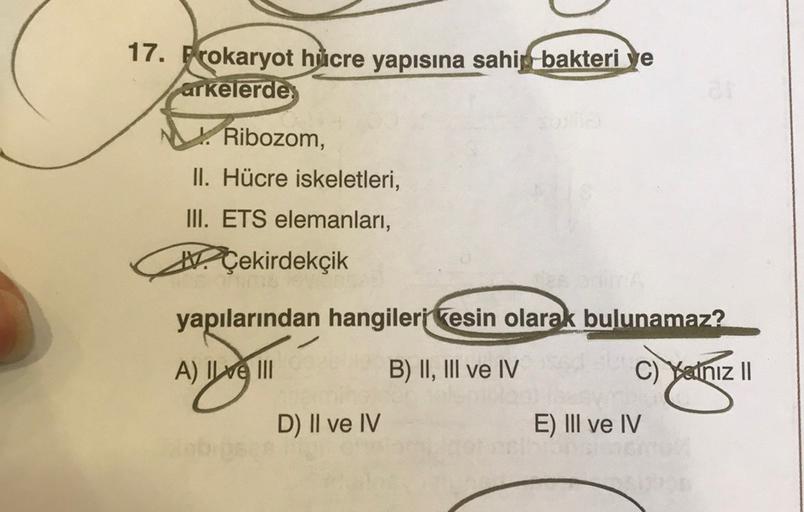 17. Prokaryot hiucre yapısına sahip bakteriye arkel… Biyoloji 17. Prokaryot hiucre yapısına sahip bakteriye arkel… Biyoloji