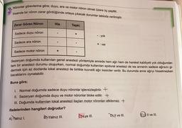 15. Nöronlar görevlerine göre; duyu, ara ve motor nöron olmak üzere üç çeşittir.
Insanda bir nöron zarar gördüğünde ortaya çıkacak durumlar tabloda verilmiştir.
Zarar Gören Nöron
His
Tepki
Sadece duyu nöron
+
- yok
Sadece ara nöron
+: var
Sadece motor nöron
+
Sezeryan doğumda kullanılan genel anestezi yöntemiyle annede hem ağrı hem de hareket kabiliyeti yok olduğundan
tam bir anestezi durumu oluşurken, normal doğumda kullanılan epidural anestezi de ise annenin sadece ağrısını gi-
dermek için az dozlarda lokal anestezi ile birlikte kuvvetli ağrı kesiciler verilir. Bu durumda anne ağrıyı hissetmezken
bacaklarını oynatabilir.
Buna göre;
1. Normal doğumda sadece duyu nöronlar işlevsizleştirilir. +
II. Sezeryan doğumda duyu ve motor nöronlar bloke edilir. +
III. Doğumda kullanılan lokal anestezi ilaçları motor nöronları etkilemez. +
ifadelerinden hangileri doğrudur?
A) Yalnız I.
BNYalnız III. Cve III. Dll ve II.
E) Il ve III.
