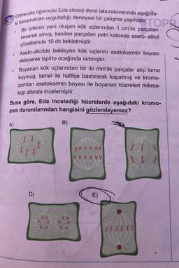 NÜniversite öğrencisi Eda sitoloji dersi laboratuvarında aşağıda-
i basamakları uyguladığı deneysel bir çalışma yapmıştır.TOP
Bir bitkinin yeni oluşan kök uçlarından 1 cm'lik parçaları
keserek almış, kesilen parçaları petri kabında aseto-alkol
çözeltisinde 10 dk bekletmiştir.
Aseto-alkolde bekleyen kök uçlarını asetokarmin boyası
ekleyerek ispirto ocağında isitmıştır.
Boyanan kök uçlarından bir iki mm'lik parçalar alıp lama
koymuş, lamel ile hafifçe bastırarak kapatmış ve kromo-
zomları asetokarmin boyası ile boyanan hücreleri mikros-
kop altında incelemiştir.
Buna göre, Eda incelediği hücrelerde aşağıdaki kromo-
zom durumlarından hangisini gözlemleyemez?
A)
B)
XX
A A A A A.
V V V V V V
IX X
D)
E)
M
1
MA
X X X X X X