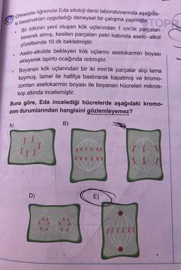 NÜniversite öğrencisi Eda sitoloji dersi laboratuvarında aşağıda-
i basamakları uyguladığı deneysel bir çalışma yapmıştır.TOP
Bir bitkinin yeni oluşan kök uçlarından 1 cm'lik parçaları
keserek almış, kesilen parçaları petri kabında aseto-alkol
çözeltisinde 10 dk bekletmiştir.
Aseto-alkolde bekleyen kök uçlarını asetokarmin boyası
ekleyerek ispirto ocağında isitmıştır.
Boyanan kök uçlarından bir iki mm'lik parçalar alıp lama
koymuş, lamel ile hafifçe bastırarak kapatmış ve kromo-
zomları asetokarmin boyası ile boyanan hücreleri mikros-
kop altında incelemiştir.
Buna göre, Eda incelediği hücrelerde aşağıdaki kromo-
zom durumlarından hangisini gözlemleyemez?
A)
B)
XX
A A A A A.
V V V V V V
IX X
D)
E)
M
1
MA
X X X X X X
