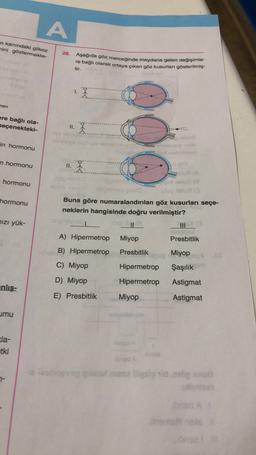 A
n kanındaki glikoz
mini göstermekte-
26. Aşağıda göz merceğinde meydana gelen değişimle-
re bağlı olarak ortaya çıkan göz kusurları gösterilmiş-
tir.
1.
man
ere bağlı ola-
seçenekteki-
II.
in hormonu
90
n hormonu
II.
hormonu
hormonu
Buna göre numaralandırılan göz kusurları seçe-
neklerin hangisinde doğru verilmiştir?
Izi yük-
III
A) Hipermetrop
Miyop
1
Presbitlik
B) Hipermetrop
Presbitlik
Miyop
C) Miyop
Hipermetrop
Şaşılık
D) Miyop
Hipermetrop
Astigmat
nlış-
E) Presbitlik
Miyop
Astigmat
umu
la-
etki
a jeho sessionida
7-
