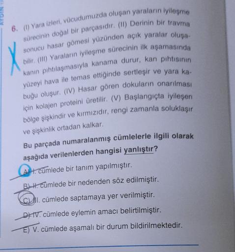 6. (0) Yara izleri, vücudumuzda oluşan yaraların iyileşme
sürecinin doğal bir parçasıdır. (1) Derinin bir travma
sonucu hasar gömesi yüzünden açık yaralar oluşa-
bilir. (Ill) Yaraların iyileşme sürecinin ilk aşamasında
kanin pıhtılaşmasıyla kanama durur, k