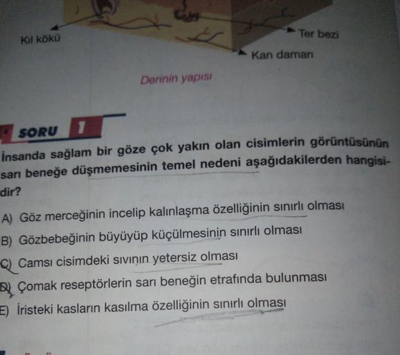 Kil kökü
Ter bezi
Kan daman
Derinin yapisi
SORU
insanda sağlam bir göze çok yakın olan cisimlerin görüntüsünün
sarı beneğe düşmemesinin temel nedeni aşağıdakilerden hangisi-
dir?
A) Göz merceğinin incelip kalınlaşma özelliğinin sınırlı olması
B) Gözbebeğin