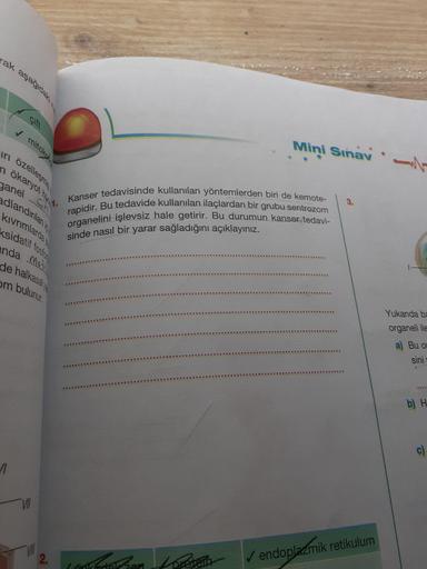 ak aşağıdakin
Mini Sinav
çift
Kanser tedavisinde kullanılan yöntemlerden biri de kemote-
rapidir. Bu tedavide kullanılan ilaçlardan bir grubu sentrozom
organelini işlevsiz hale getirir. Bu durumun kanser tedavi-
sinde nasıl bir yarar sağladığını açıklayını