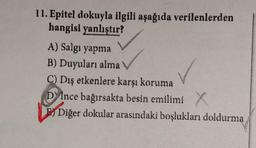 11. Epitel dokuyla ilgili aşağıda verilenlerden
hangisi yanlıştır?
A) Salgı yapma
B) Duyuları alma
C) Dış etkenlere karşı koruma
D Ince bağırsakta besin emilimi X
Diğer dokular arasındaki boşlukları doldurma