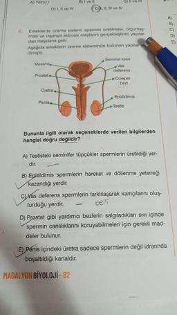 A) Yalnız!
B) I ve II
C) Il ve Il
E). II, III ve IV
D) I, II ve IV
6.
Erkeklerde üreme sistemi spermin üretilmesi, olgunlaş-
ması ve dışarıya atılması olaylarını gerçekleştiren yapılar-
dan meydana gelir.
Aşağıda erkeklerin üreme sisteminde bulunan yapılar ve
rilmiştir.
E)
Seminal kese
Mesane
Vas
deferens
Prostat
Cowper
bezi
Üretra
ch
Epididimis
Penis
Testis
Bununla ilgili olarak seçeneklerde verilen bilgilerden
hangisi doğru değildir?
A) Testisteki seminifer tüpçükler spermlerin üretildiği yer-
dir.
B) Epididimis spermlerin hareket ve döllenme yeteneği
kazandığı yerdir.
c) Vas deferens spermlerin farklılaşarak kamçılarını oluş-
turduğu yerdir
.
belli
D) Prostat gibi yardımcı bezlerin salgıladıkları sıvı içinde
spermin canlılıklarını koruyabilmeleri için gerekli mad-
deler bulunur.
E) Penis içindeki üretra sadece spermlerin değil idrarında
boşaltıldığı kanaldır.
MADALYON BİYOLOJİ - 82
