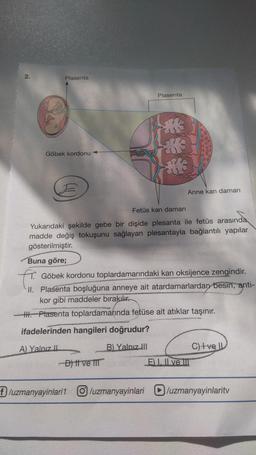 2.
Plasenta
Plasenta
an
Göbek kordonu
34
Anne kan damarı
Fetüs kan damarı
Yukarıdaki şekilde gebe bir dişide plesanta ile fetüs arasında
madde değiş tokuşunu sağlayan plesantayla bağlantılı yapılar
gösterilmiştir.
Buna göre;
f
Göbek kordonu toplardamarındaki kan oksijence zengindir.
II. Plasenta boşluğuna anneye ait atardamarlardan besin, anti-
kor gibi maddeler bırakılır.
1. Plasenta toplardamarında fetüse ait atıklar taşınır.
ifadelerinden hangileri doğrudur?
A) Yalnız Il
B) Yalnız III
C) ve
Dit ve III
EL. I ve III
f/uzmanyayinlari1 /uzmanyayinlari
D/uzmanyayinlarity