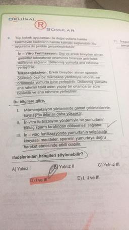 ORİJİNAL
R
SORULAR
9.
11. insand
şemal
Tüp bebek uygulaması ile doğal yollaria hamile
kalamayan kadınların hamile kalması sağlanabilir. Bu
uygulama iki şekilde gerçekleştirilebilir:
In - Vitro Fertilizasyon: Dişi ve erkek bireyden alınan
gametler laboratuvar ortamında biraraya getirilerek
dollenme sağlanır. Döllenmiş yumurta ana rahmine
yerleştirilir.
Mikroenjeksiyon: Erkek bireyden alınan spermin
çekirdeği özel bir mikroskop yardımıyla laboratuvar
ortamında yumurta içine yerleştirilir. Döllenmiş yumurta
ana rahmini taklit eden yapay bir ortamda bir süre
bekletilir ve ana rahmine yerleştirilir.
Bu bilgilere göre,
I. Mikroenjeksiyon yönteminde gamet çekirdeklerinin
kaynaşma ihtimali daha yüksektir.
II. In-vitro fertilizasyon yöntemiyle bir yumurtanın
birkaç sperm tarafından döllenmesi sağlanır.
III. In - vitro fertilizasyonda yumurtanın salgıladığı
kimyasal maddeler, spermin yumurtaya doğru
hareket etmesinde etkili olabilir.
-
ifadelerinden hangileri söylenebilir?
B) Yalnız II
C) Yalnız III
A) Yalnız
D) I ve III
E) I, II ve III
