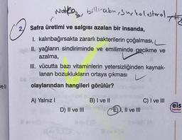 Walto, billinebin, sup kolesterol the
| 3
C
Safra üretimi ve salgısı azalan bir insanda,
1. kalınbağırsakta zararlı bakterilerin çoğalması,
II. yağların sindiriminde ve emiliminde gecikme ve
azalma,
III. vücutta bazı vitaminlerin yetersizliğinden kaynak-
lanan bozuklukların ortaya çıkması v V
olaylarından hangileri görülür?
Je IV
A) Yalnız 1
B) I ve II
C) I ve III
D) II ve III
Fri, Il ve III
eis
Yayinlar
NO
