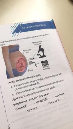 Kazandıran Yeni Nesil
aşağıdaki şemada amniyosentezin yapılma şekli gösteril-
miştir.
Mikroskobik
inceleme
Amniyotik
SIVI
Ultrason
kontrolü
Fetus
Amniyosentez yöntemiyle ilgili,
1. Fetüste kromozom anormalliği olup olmadığının tes-
pit edilmesini sağlayabilir.
II. Plasentadan alınan hücrelerin incelenmesiyle yapılır.
III Fetüsün cinsiyetini belirlemek için yapılır.
yargılarından hangileri doğrudur?
A) Yatriz Bt Yalnız ilt vett
D) II ve III
E) I, II ve III
kul
