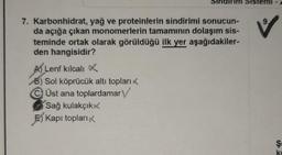 Sister
9
7. Karbonhidrat, yağ ve proteinlerin sindirimi sonucun-
da açığa çıkan monomerlerin tamamının dolaşım sis-
teminde ortak olarak görüldüğü ilk yer aşağıdakiler-
den hangisidir?
A Lenf kılcali
8) Sol köprücük altı topları
Üst ana toplardamar
Sağ kulakçık
E) Kapı topları,
$
