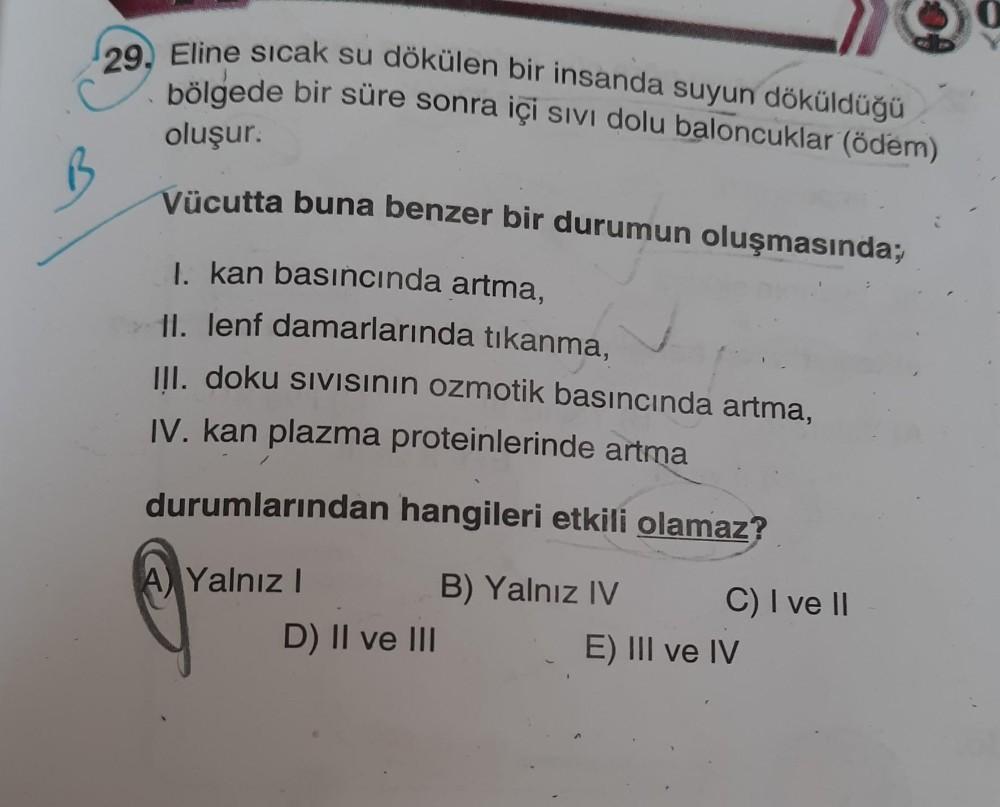 29, Eline sıcak su dökülen bir insanda suyun döküld... - Biyoloji
