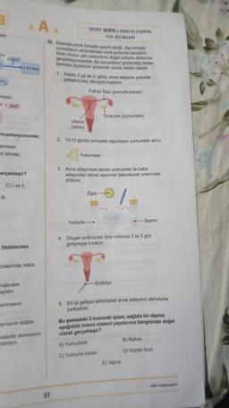 AA
DH
NAD
SEDEF SERISI / ONO2-55.31AYTOS
TEN BILIMLERİ
32. Insanda erkek bireyde spermezligi, dini bireyde
yumurtanın atlamaması veya yumurta kanalinin
tikal olması gibi nedenlerle doğal yollara dolerme
gerçekleşmeyebilir
. Bu durumların gözlendi aileler,
pemada açıklanan yöntemle çocuk sahibi olabilir
1 Adetin 2 ya da 3, günü, anne adayına yumurta
geliştirici ilaç takviyesi başlanır,
Fallopi topa (yumurta kanali)
co
NADH
2 NAD
Ovaryum (yumurtalik)
Uterus
(rahim)
mantasyonunda;
2. 10-12 günün sonunda olgunlaşan yumurtalar alınır.
enmesi
en almasi.
Yumurtalar
merçekleşir?
3. Anne adayından alınan yumurtalar ile baba
adayından alınan spermler laboratuvar ortamında
döllenir.
C) I ve 11
Zigot -
III
Yumurta -
Sperm
4. Oluşan embriyolar Ozel ortamda 3 ile 5 gün
gelişmeye birakilir.
ifadelerden
orelerinde mitoz
halinden
-Embriyo
aşlatır
anmasini
masını sağlar.
5. En iyi gelişen embriyolar anne adayınin uterusuna
yerleştirilir
,
Bu şemadaki 3 numaralı işlem, sağlıklı bir dişinin
aşağıdaki üreme sistemi yapılarının hangisinde doğal
olarak gerçekleşir?
A) Yumurtalık
B) Rahim
walarda stomalann
landin
D) Kirpikli huni
C) Yumurta kanali
E) Vajina
37
