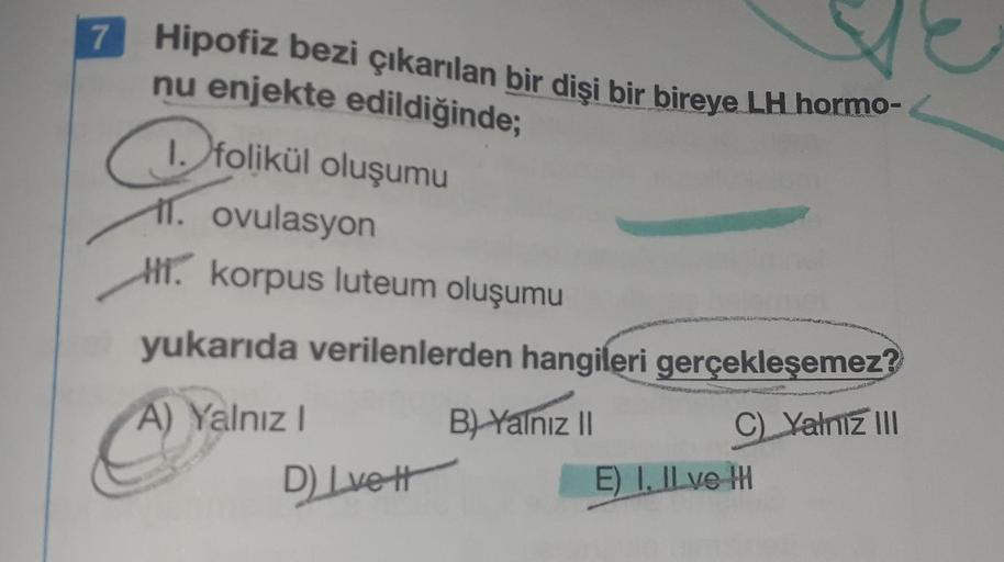 7
Hipofiz bezi çıkarılan bir dişi bir bireye LH hormo-
nu enjekte edildiğinde;
folikül oluşumu
11. ovulasyon
HTC korpus luteum oluşumu
1. to
yukarıda verilenlerden hangileri gerçekleşemez?
A) Yalnız!
B) Yalnız II
C Yalniz III
E) I. Il ve IH
Dirett
