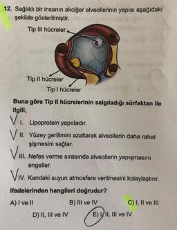 12. Sağlıklı bir insanın akciğer alveollerinin yapısı aşağıdaki
şekilde gösterilmiştir.
Tip III hücreler
Tip II hücreler
Tip I hücreler
Buna göre Tip II hücrelerinin salgıladığı sürfaktan ile
ilgili,
V. Lipoprotein yapıdadır.
V 1. Yüzey gerilimini azaltarak alveollerin daha rahat
şişmesini sağlar.
V.
III. Nefes verme sırasında alveollerin yapışmasını
engeller.
Viv
. Kandaki suyun atmosfere verilmesini kolaylaştırır.
ifadelerinden hangileri doğrudur?
A) I ve II
B) III ve IV
C) I, II ve III
D) II, III ve IV E) VII, III ve IV