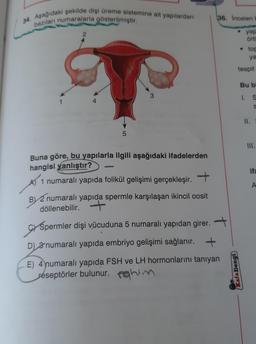 34. Aşağıdaki şekilde dişi üreme sistemine ait yapılardan
bazıları numaralarla gösterilmiştir.
36. Incelent
•
2
yap
Ört
• tog
ya
tespit
Bu bi
3
1. S
1
4
II.
5
III.
ifa
Buna göre, bu yapılarla ilgili aşağıdaki ifadelerden
hangisi yanlıştır?
1 numaralı yapıda folikül gelişimi gerçekleşir. +
By 2 numaralı yapıda spermle karşılaşan ikincil oosit
döllenebilir. +
A
+
GY Spermler dişi vücuduna 5 numaralı yapıdan girer.
D) 3 numaralı yapıda embriyo gelişimi sağlanır.
E) 4 numaralı yapıda FSH ve LH hormonlarını tanıyan
reseptörler bulunur. rahim
Kafa Dengi