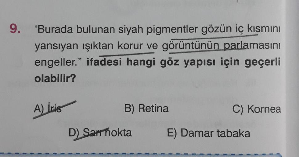 9.
'Burada bulunan siyah pigmentler gözün iç kısmını
yansıyan ışıktan korur ve görüntünün parlamasını
engeller." ifadesi hangi göz yapısı için geçerli
olabilir?
A) Iris
B) Retina
C) Kornea
D) Sar nokta
E) Damar tabaka
