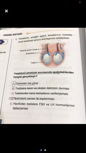 ÜREME SİSTEMİ
5
Jamak
4. Vazektomi, erkeğin sperm kanallarının (vasdefe-
rens) kesilmesi sonucu kısırlaştırma ameliyatıdır.
Kesilmiş sperm kanalı +
Epididimis
Testis -
Vazektomi ameliyatı sonrasında aşağıdakilerden
hangisi gerçekleşir?
Üretradan üre çıkışı