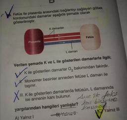 Fetüs ile plasenta arasındaki bağlantıyı sağlayan göbek
kordonundaki damarlar aşağıda şematik olarak
gösterilmiştir.
K damarları
Plasenta
Fetüs
L damarı
Verilen şemada K ve L ile gösterilen damarlarla ilgili;
VK ile gösterilen damarlar O₂ bakımından fakirdir.
H. Monomer besinler anneden fetüse L damarı ile
taşınır.
XII.
III. K ile gösterilen damarlarda fetüsün, L damarında
ise annenin kanı bulunur. Anne ite fotos
yargılarından hangileri yanlıştır?
birbime
Kosmot
A) Yalnız I
www
B) Yalnız
Yalnız III
11
V