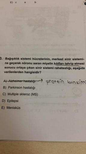 E) C
b
0. Bağışıklık sistemi hücrelerinin, merkezî sinir sistemi-
ne geçerek nöronu saran miyelin kılıfları tahrip etmesi
sonucu ortaya çıkan sinir sistemi rahatsızlığı, aşağıda
verilenlerden hangisidir?
A) Alzheimer hastalığı protein binkim
B) Parkinson h