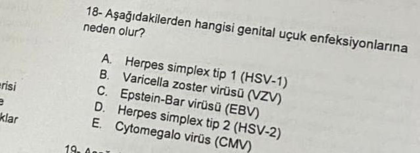 erisi
e
klar
1.9.
18- Aşağıdakilerden hangisi genital uçuk enfeksiyonlarına
neden olur?
A. Herpes simplex tip 1 (HSV-1)
B. Varicella zoster virüsü (VZV)
C. Epstein-Bar virüsü (EBV)
D. Herpes simplex tip 2 (HSV-2)
E. Cytomegalo virüs (CMV)