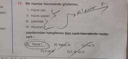 lar.
esin
ışın-
10 D
11 A
12. Bir mantar hücresinde gözlenen,
1. hücre zarı
II. hücre çeperi
III. çekirdek
IV. ribozom
yapılarından hangilerine tüm canlı hücrelerde rastla-
12
nır?
A Yalnız T
D) II ve
B) Yalnız III
or h
Alyover
Clive IV
E) I, II ve IV