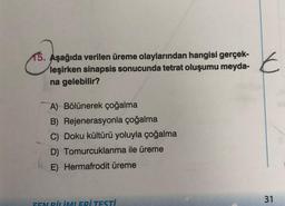 15. Aşağıda verilen üreme olaylarından hangisi gerçek-
leşirken sinapsis sonucunda tetrat oluşumu meyda-
na gelebilir?
7
A) Bölünerek çoğalma
B) Rejenerasyonla çoğalma
C) Doku kültürü yoluyla çoğalma
D) Tomurcuklanma ile üreme
E) Hermafrodit üreme
FEN BİLİMLERİ TESTİ
E
31