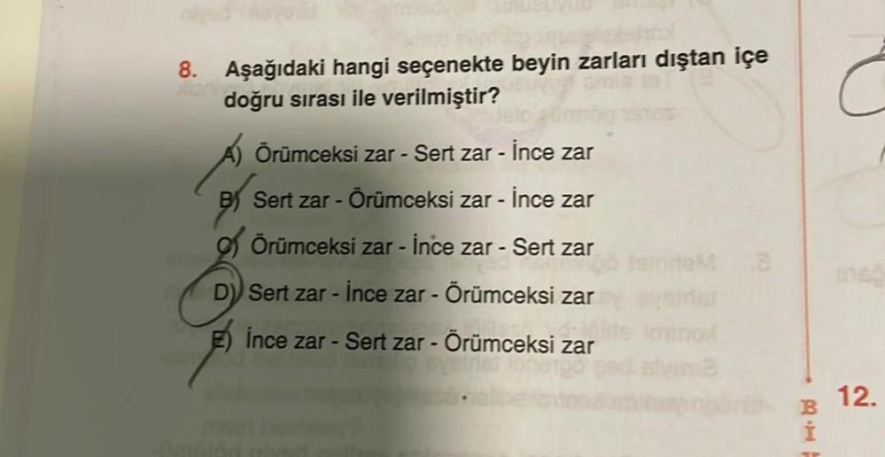 8.
Aşağıdaki hangi seçenekte beyin zarları dıştan içe
doğru sırası ile verilmiştir?
Á) Örümceksi zar - Sert zar - İnce zar
B Sert zar - Örümceksi zar - İnce zar
Örümceksi zar - İnce zar - Sert zar
D) Sert zar -
- İnce zar - Örümceksi zar
İnce zar - Sert za