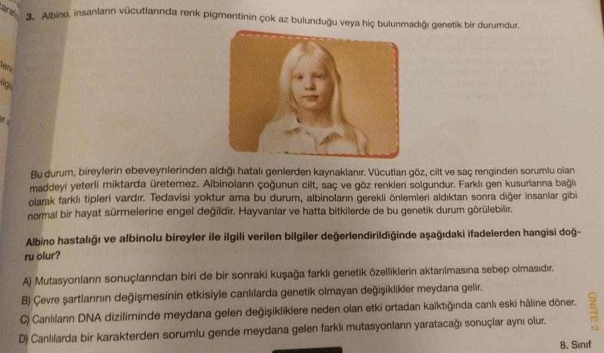 Carafin
3. Albino, insanların vücutlarında renk pigmentinin çok az bulunduğu veya hiç bulunmadığı genetik bir durumdur.
leni
ilgile
er a
Bu durum, bireylerin ebeveynlerinden aldığı hatalı genlerden kaynaklanır. Vücutları göz, cilt ve saç renginden sorumlu 