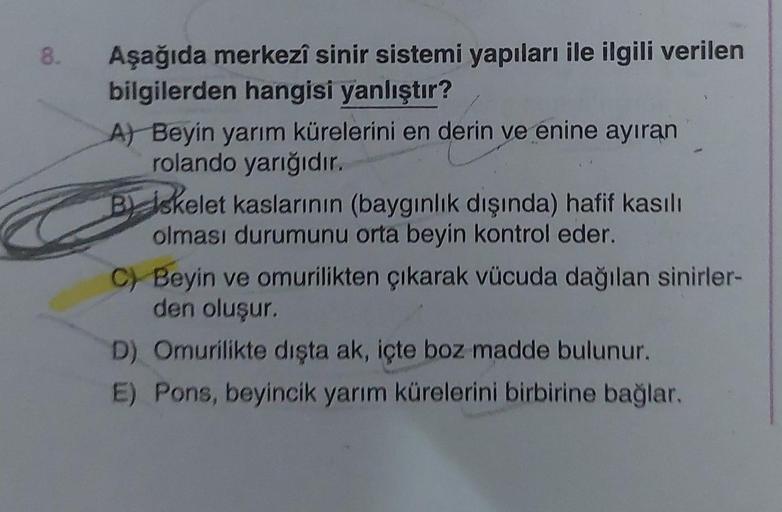 8.
Aşağıda merkezî sinir sistemi yapıları ile ilgili verilen
bilgilerden hangisi yanlıştır?
A) Beyin yarım kürelerini en derin ve énine ayıran
rolando yarığıdır.
B iskelet kaslarının (baygınlık dışında) hafif kasılı
olması durumunu orta beyin kontrol eder.