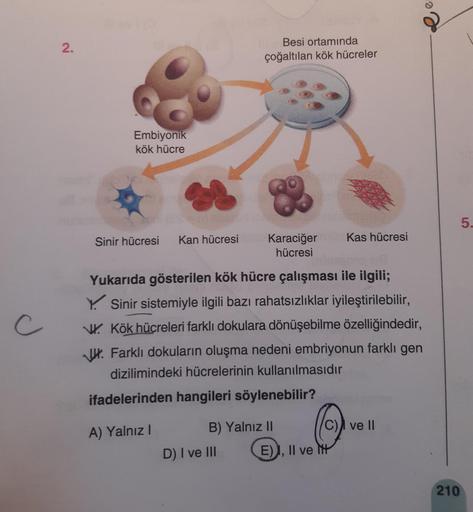 U
2.
Embiyonik
kök hücre
Sinir hücresi
Kan hücresi
Besi ortamında
çoğaltılan kök hücreler
D) I ve III
Achni
Karaciğer Kas hücresi
hücresi
Yukarıda gösterilen kök hücre çalışması ile ilgili;
Y Sinir sistemiyle ilgili bazı rahatsızlıklar iyileştirilebilir,
K