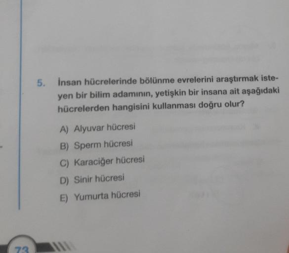 73
5.
İnsan hücrelerinde bölünme evrelerini araştırmak iste-
yen bir bilim adamının, yetişkin bir insana ait aşağıdaki
hücrelerden hangisini kullanması doğru olur?
A) Alyuvar hücresi
B) Sperm hücresi
C) Karaciğer hücresi
D) Sinir hücresi
E) Yumurta hücresi