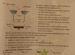 13.
Kadın çorabı
Delikli
kap
Huni
Plastik
boru
Şekerleme
Çamurlu
su
Bir öğrenci, sağlıklı bir boşaltım sistemini modellemek
için aşağıdaki işlemleri gerçekleştiriyor.
.
.
.
İki adet huninin ağzına ince gözenekli bir yapıya sa-
hip kadın çorabını geçiriyor.
Hunilerin uçlarına plastik boru takıyor.
Boruların açık uçlarının altına bir kap yerleştiriliyor
ve bakın alt kısmına açtığı deliği tipa ile kapatıyor.
Çamurlu bir su hazırlayıp içine suda çözünmeyen
şekerlemeler atıyor.
Hazırladığı karışımı hunilerin üstünden döküyor.
Delikli kapta biriken sıvı çoğaldığında tıpayı açarak
çamurlu suyu boşaltıyor.
Tipa
Öğrenci, yaptığı etkinlik sonunda delikli kapta çamurlu suyun toplandığını şekerlemelerin ise bir miktar
çamur kalıntısıyla birlikte hunilerin üstünde kaldığını gözlemliyor.
Buna göre öğrenci yaptığı etkinlik ile ilgili;
1. Sağlıklı bir insanın idrarında glikoz bulunmaz.
II. Böbrekler ile kandaki tüm zararlı atıkların vücut dışına atılması sağlanır.
III. Boşaltım sistemi; idrarı oluşturan idrarı bir süre depolayan ve oluşan idrarın vücut dışına taşınma-
sını sağlayan yapılardan oluşur.
çıkarımlarından hangilerine ulaşabilir?
A) Yalnız I
B) I ve Il
Ive III
D) II ve III