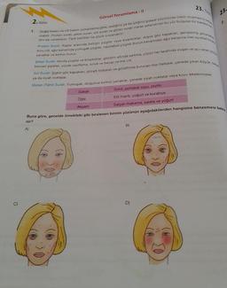 C)
A)
1.
Görsel Yorumlama - II
2. Bölüm
olabilir. Protein suratı, şeker suratı, süt suratı ve glüten suratı olarak adlandırılan bu yüz bulguları bir bakışta ken
Doğal tedavi ve cilt bakım uzmanlarına göre, yediğiniz ya da içtiğiniz gıdalar yüzünüzde izlerin oluşmasına sebep
dini ele verebiliyor. Tipik belirtiler ise şöyle sıralanabilir:
kuru cilt, ağız kenarında yumuşak çizgiler, nazolabial çizgiler (burun kenarından ağız kenarına inen oyuklar) kızarık
Protein Suratı: Kaşlar arasında belirgin çizgiler veya kızarıklıklar, düşük göz kapakları, genişlemiş gözenekle
yanaklar ve kırmızı burun.
Şeker Suratı: Alında çizgiler ve kırışıklıklar, gözlerin altında sarkma, yüzün her tarafında oluşan ve acı veren Sivilc
benzeri şişlikler, yüzde zayıflama, soluk ve beyaz renkte cilt.
Sabah
Öğle
Akşam
23-Test
Süt Suratı: Şişkin göz kapakları, gözaltı torbaları ve gözaltında bulunan mor halkalar, çenede çıkan küçük, beyaz
ya da siyah noktalar.
Glüten (Tahil) Surati: Yumuşak, dolgunve kırmızı yanaklar, çenede siyah noktalar veya koyu lekelenmeler.
Simit, portakal suyu, zeytin
Etli mantı, yoğurt ve kurabiye
Salçalı makarna, salata ve yoğurt
B)
23.
Buna göre, genelde örnekteki gibi beslenen birinin yüzünün aşağıdakilerden hangisine benzemesi bekle
nir?
D)
2.