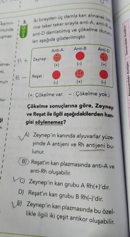 karnın-
munda
uşmaz-
elme-
esi,
nun
I
bu- 1
I
I
I
3.
B
S
İki bireyden üç damla kan alınarak üze
rine teker teker sırayla anti-A, anti-B ve
anti-D damlatılmış ve çökelme durum.
ları aşağıda gösterilmiştir.
A+ Zeynep :
Reşat :
Anti-A
(+)
Anti-B
(+)
Anti-D
(+)
I
(-)
(+: Çökelme var. - : Çökelme yok.)
Çökelme sonuçlarına göre, Zeynep
ve Reşat ile ilgili aşağıdakilerden han-
gisi söylenemez?
A) Zeynep'in kanında alyuvarlar yüze-
yinde A antijeni ve Rh antijeni bu-
lunur.
B) Reşat'ın kan plazmasında anti-A ve
anti-Rh oluşabilir.
VC) Zeynep'in kan grubu A Rh(+)'dir.
D) Reşat'ın kan grubu B Rh(-)'dir.
LE) Zeynep'in kan plazmasında bu özel-
likle ilgili iki çeşit antikor oluşabilir.
Serumdaki Antikor
Alyuvardaki Antijen