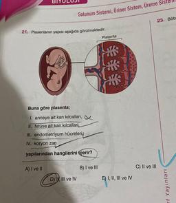 21. Plasentanın yapısı aşağıda görülmektedir.
Solunum Sistemi, Üriner Sistem, Üreme Sis
Buna göre plasenta;
1. anneye ait kan kılcalları,
II. fetüse ait kan kılcallari,
III. endometriyum hücreleri
IV. koryon zarı
yapılarından hangilerini içerir?
A) I ve II
DYI, III ve IV
B) I ve III
Plasenta
Laffs
H
S
E) I, II, III ve IV
C) II ve III
23. Böb
rf Yayınları