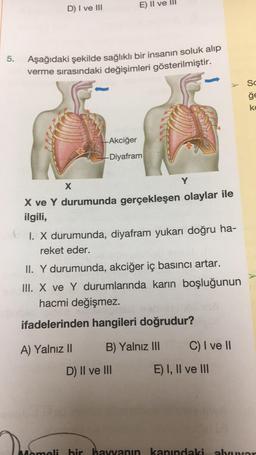 5.
D) I ve III
Aşağıdaki şekilde sağlıklı bir insanın soluk alıp
verme sırasındaki değişimleri gösterilmiştir.
X
E) Il ve
Akciğer
-Diyafram
X ve Y durumunda gerçekleşen olaylar ile
ilgili,
A) Yalnız II
1. X durumunda, diyafram yukarı doğru ha-
reket eder.
Y
II. Y durumunda, akciğer iç basıncı artar.
III. X ve Y durumlarında karın boşluğunun
hacmi değişmez.
ifadelerinden hangileri doğrudur?
B) Yalnız III
D) II ve III
C) I ve II
E) I, II ve III
100
Sc
ğe
ko
Momeli bir hayvanın kanındaki alvuvar