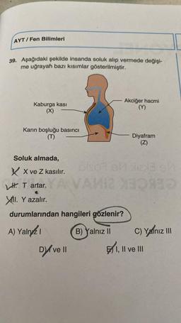 AYT/Fen Bilimleri
39. Aşağıdaki şekilde insanda soluk alıp vermede değişi-
me uğrayan bazı kısımlar gösterilmiştir.
Kaburga kası
(X)
Karın boşluğu basıncı
(T)
Soluk almada,
XX ve Z kasılır.
HT artar.
YA
XI. Y azalır.
durumlarından hangileri gözlenir?
A) Yalnız
B) Yalnız II
Dy ve II
||
Akciğer hacmi
(Y)
Diyafram
(Z)
blo al liz
213
VAI
VAMIZ XOREO
C) Yalnız III
I, II ve III