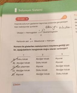 Solunum Sistemi
Örnek 4
İnsanda solunum gazlarının taşınması sırasında gerçekleşen
bazı reaksiyonlar şunlardır:
Aleiger kilcolları
Oksijen + Hemoglobin
Karbonik asit
3
1
A Doku kılcalı
B) Akciğer kılcalı
C) Kan plazması
D) Akciğer kılcalı
Alyuvar
Çözüm
2
Bikarbonat + Hidrojen
Numara ile gösterilen reaksiyonların meydana geldiği yer-
ler, aşağıdakilerin hangisinde doğru olarak verilmiştir?
Oksihemoglobin
2
Akciğer kılcalı
Doku kılcalı
Alyuvar
Doku kılcalı
Akciğer kılcalı
3
Alyuvar
Alyuvar
Akciğer kılcalı
Akciğer kılcalı
Doku kılcalı
Pn
Ak
da
le
ru
b