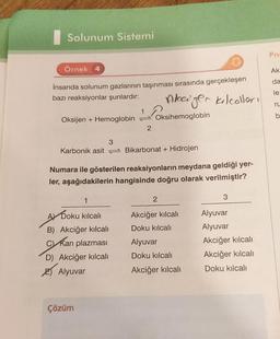 Solunum Sistemi
Örnek 4
İnsanda solunum gazlarının taşınması sırasında gerçekleşen
bazı reaksiyonlar şunlardır:
Aleiger kilcolları
Oksijen + Hemoglobin
Karbonik asit
3
1
A Doku kılcalı
B) Akciğer kılcalı
C) Kan plazması
D) Akciğer kılcalı
Alyuvar
Çözüm
2
Bikarbonat + Hidrojen
Numara ile gösterilen reaksiyonların meydana geldiği yer-
ler, aşağıdakilerin hangisinde doğru olarak verilmiştir?
Oksihemoglobin
2
Akciğer kılcalı
Doku kılcalı
Alyuvar
Doku kılcalı
Akciğer kılcalı
3
Alyuvar
Alyuvar
Akciğer kılcalı
Akciğer kılcalı
Doku kılcalı
Pn
Ak
da
le
ru
b