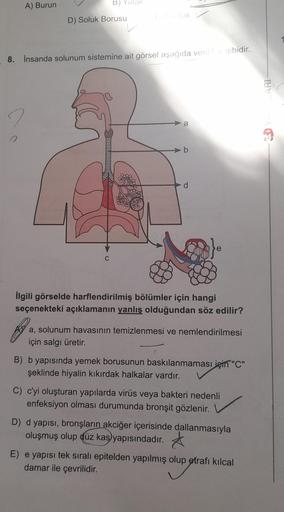 A) Burun
B) Yutak
D) Soluk Borusu
C
Tatlak
8. İnsanda solunum sistemine ait görsel aşağıda veriler gibidir.
b
d
İlgili görselde harflendirilmiş bölümler için hangi
seçenekteki açıklamanın yanlış olduğundan söz edilir?
a, solunum havasının temizlenmesi ve n